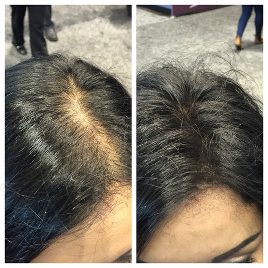 RETAIL BOSLEY MD BOS.VOLUMIZE HAIR THICKENING FIBERS