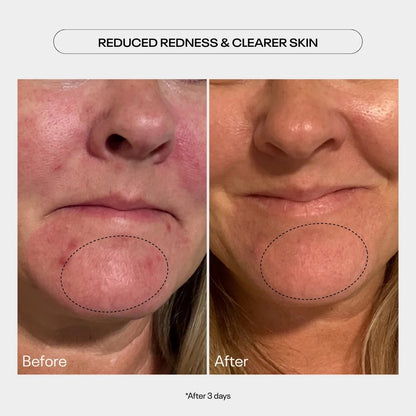 TUEL AHA MOMENT DOUBLE ACTION RESURFACING SERUM