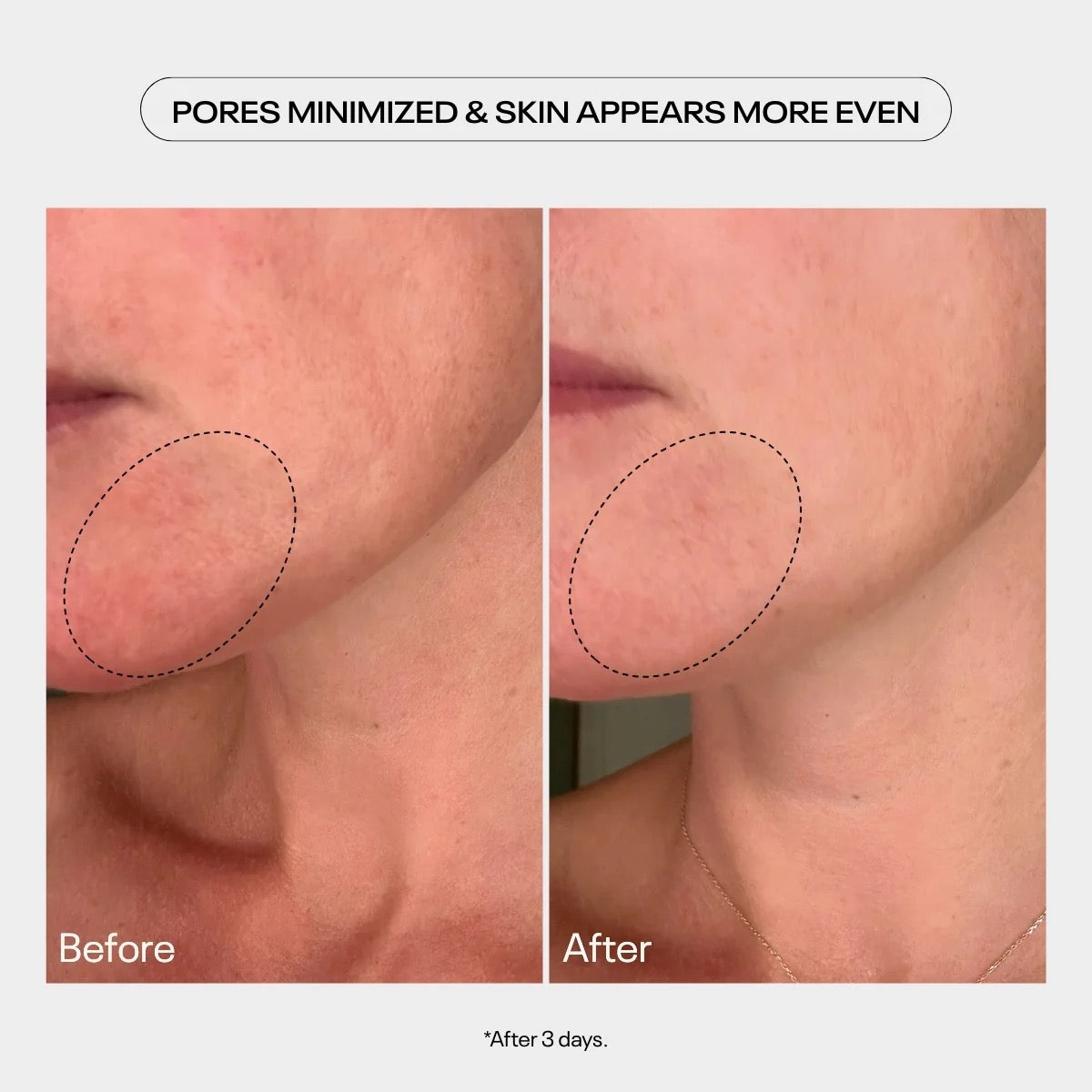 TUEL AHA MOMENT DOUBLE ACTION RESURFACING SERUM