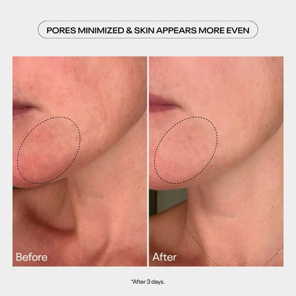 TUEL AHA MOMENT DOUBLE ACTION RESURFACING SERUM